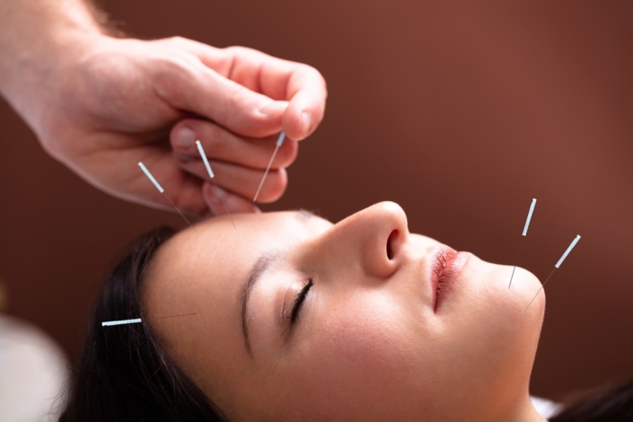 Cosmetic Acupuncture Olson Acupuncture Group 5977